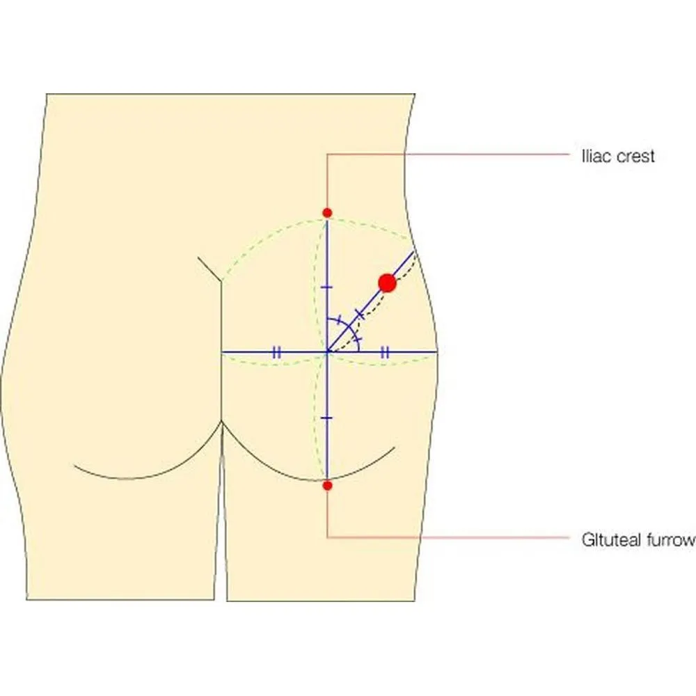 Koken Gluteal Intramuscular Injection Model